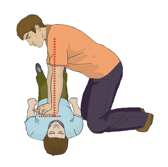 Положение тела при СЛР