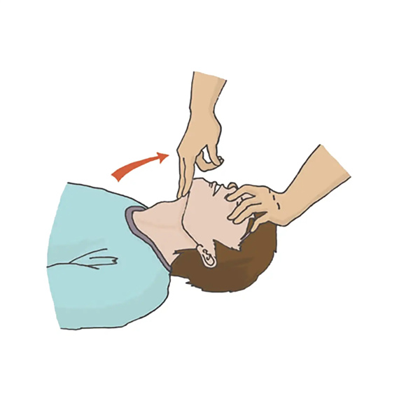 Положение головы пострадавшего для искусственного дыхания